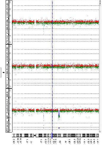 MK löydösten ilmoitus lausunnoissa Tunnetut mikrodeleetio/duplikaatiosyndroomat kliinisesti merkittävät, patologiset CNVt VOUS = variant of unknown significance, tuloksen merkitys epäselvä likely