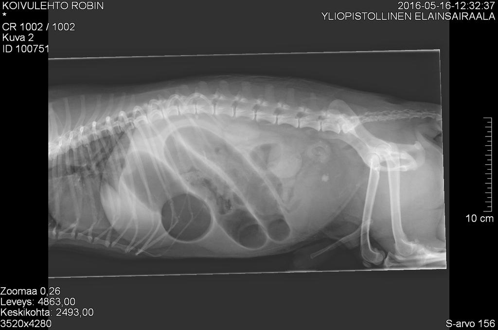 2.3.3 Vierasesineen aiheuttamat tyypilliset muutokset röntgenkuvassa Vierasesine voi olla röntgentiivis, jolloin se näkyy selvästi röntgenkuvassa, kuten esimerkiksi metalli, joka absorboi lähes