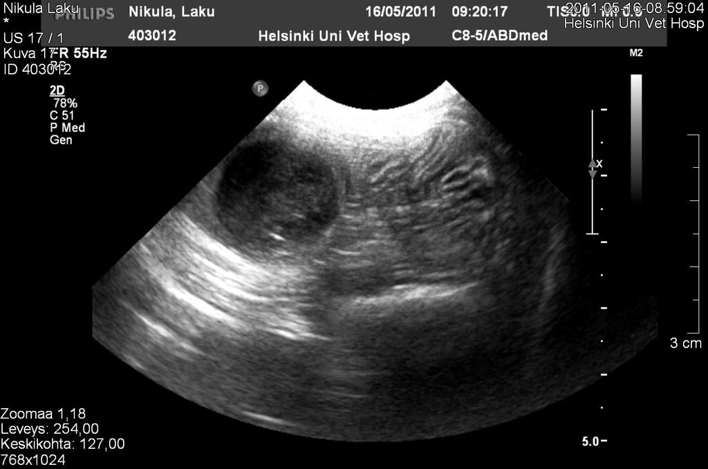 niistä vierasesineistä, jotka eivät heijasta ultraääniaaltoja takaisin ja voimakasta kaikukatvetta ei muodostu.