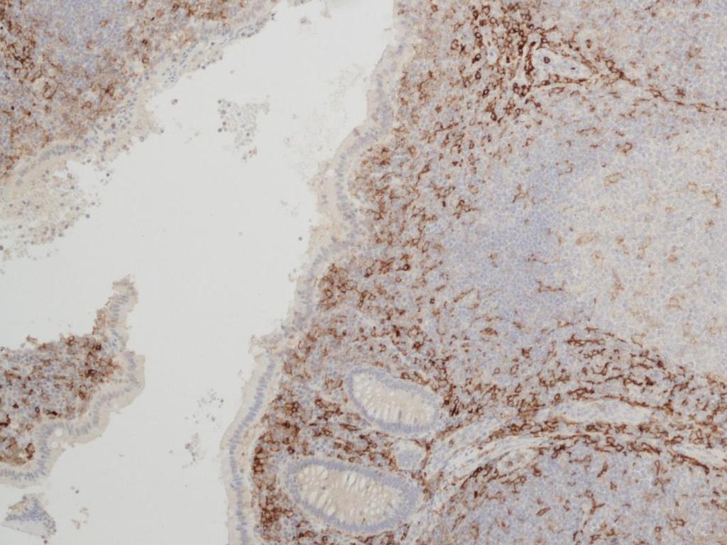 15 Novocastra TM Liquid Mouse Monoclonal Antibody CD33 CD33-antigeeni havaitaan myelomonosyyttisten solujen solukalvoilla ja sytoplasmassa.