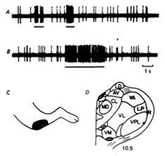 fosforylaatiomuutokset, LTP & varhaisgeenimuutokset => solun toiminnan pitkäaikaismuutokset Substance P Glutamate Perifeerinen kipuneuroni IHO Spinotalaminen rata (somaattinen kipu) Useita