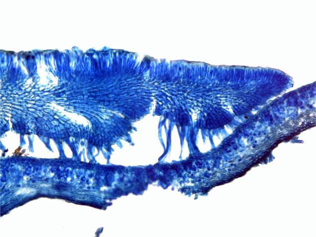 Cross section through hymenium of Coccocarpia erythroxyli.