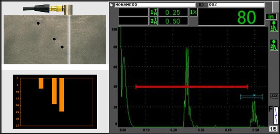 116 Kuva 62. Vasemmalla tyypillinen B-kuva, oikealla tyypillinen A-kuva (52). A-kuvassa (kuva 63) esiintyy yleensä useiden eri kaikujen signaaleja.