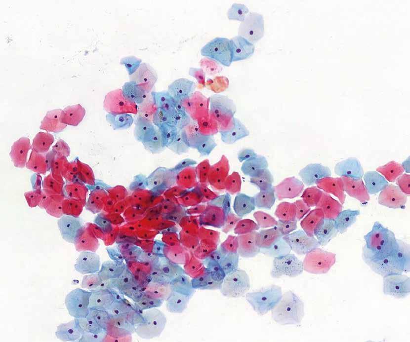6600, 6600S Immunohistokemialliset värjäykset Aiheet 2018: 1. kierros (maaliskuu): CD1a, CD43, CD45, CD30, CyclinD1 (lymfooma) 2. kierros (syyskuu): ER, PR, Ki-67, HER2, GATA3 (rintasyöpä) 3.
