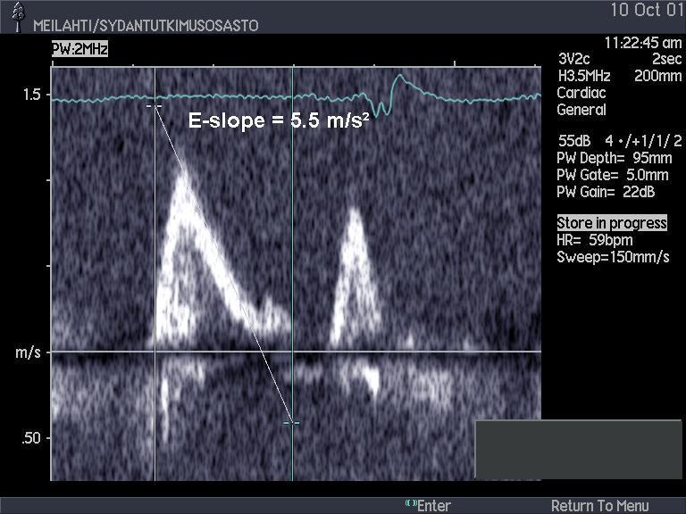 Täyttöpaineen arvio kaikukuvauksella Mitraalivirtau s E/Em-suhde alle 8,
