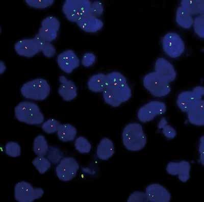 Immunohistokemia Luotettavaa ja yksinkertaista detektiota FISH- ja CISH-analyyseilla Korkealaatuinen Fluorescence In Situ (FISH) ja Chromogenic In Situ (CISH) -hybridisaatio Vasta-aineet parafiini-