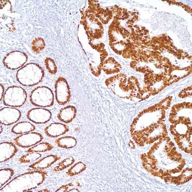 tulkintaan Lukuisia validoituja vasta-aineita mm. virtaussytometriaan, immunohistokemiaan, immunosaostukseen ja Western Blottingiin.