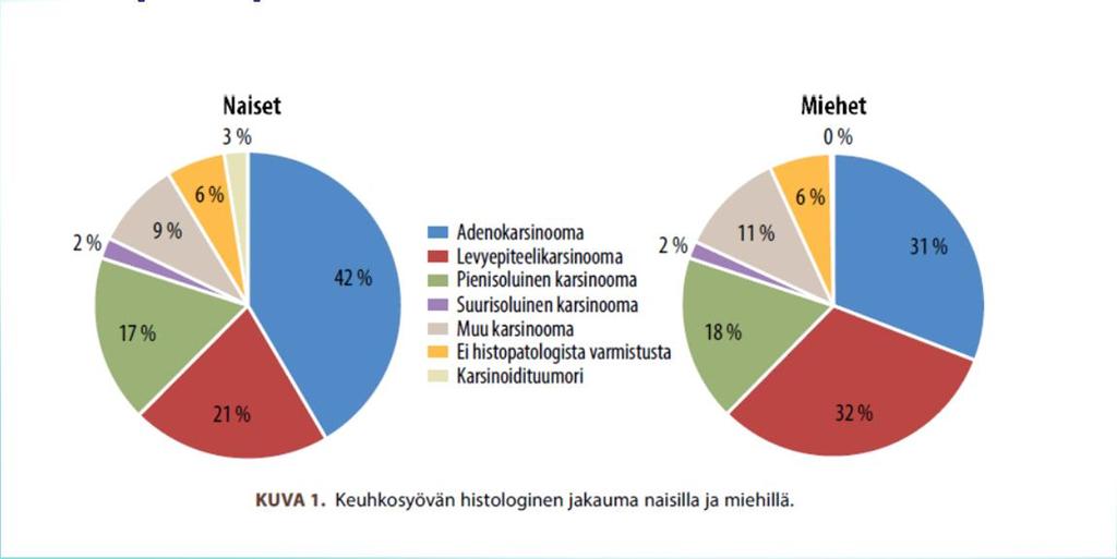 Keuhkosyövän histologinen jakauma Tyks-piirissä: 1542 potilasta Naisia 34 % Keski-ikä 69.2 v Salomaa E-R ja Walta M.