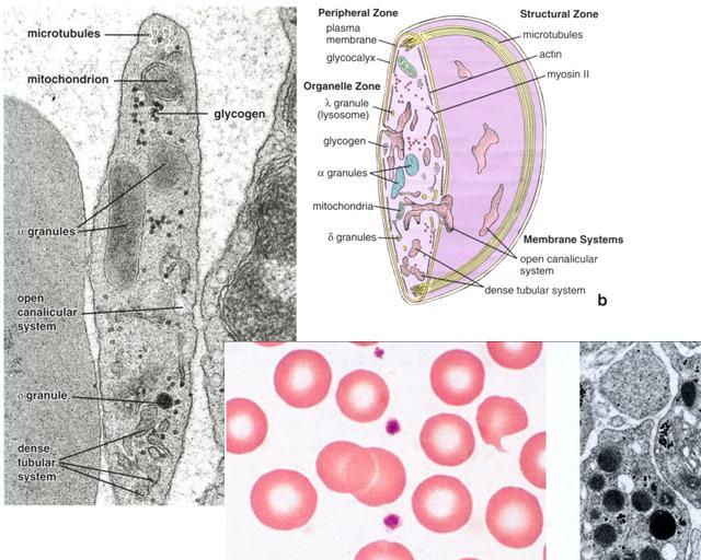 6. Lipidien käsittely: Endoteelisolut tuottavat vapaita radikaaleja, jotka hapettavat intimaan joutuneita lipoproteiineja. Makrofagit ja sileälihassolut syövät nämä lipidit, muuttuvat vaahtosoluiksi.