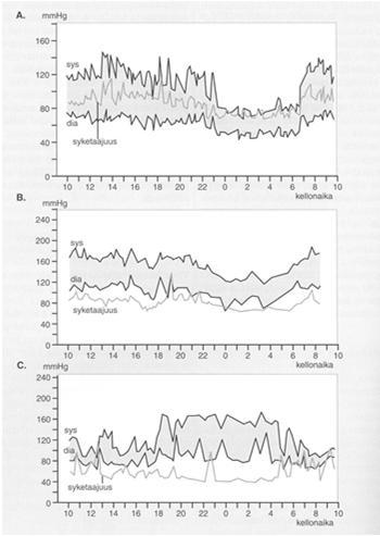 ajoittain hypertensiiviset verenpainearvot verenpainelääkityksen tehon arviointi lääkityksen teho vuorokauden eri aikoina verenpaineen vuorokausivaihtelun arviointi työssä, nukkuessa etc.