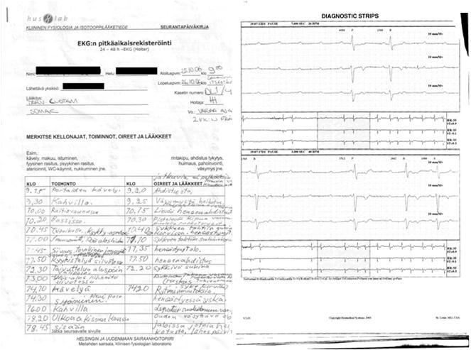 ) EKG:n pitkäaikaisrekisteröinnin tärkeimpiä käyttöaiheíta rytmihäiriöön viittaavat hankalat oireet, joitten aikaista EKG:ta ei muuten saatu