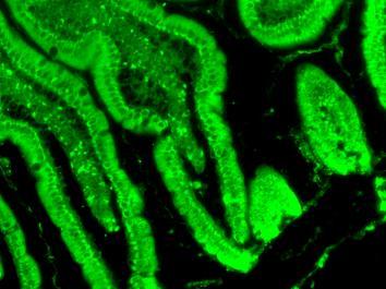 fluoresoivia kohtia, joita ei havaita kontrolleissa (FITC-suodatin, 470 nm, 99 % intensiteetti, 110 ms valotusaika).