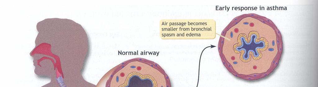 bronchodilation