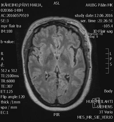 AVH POTILASTAPAUS 1 20: