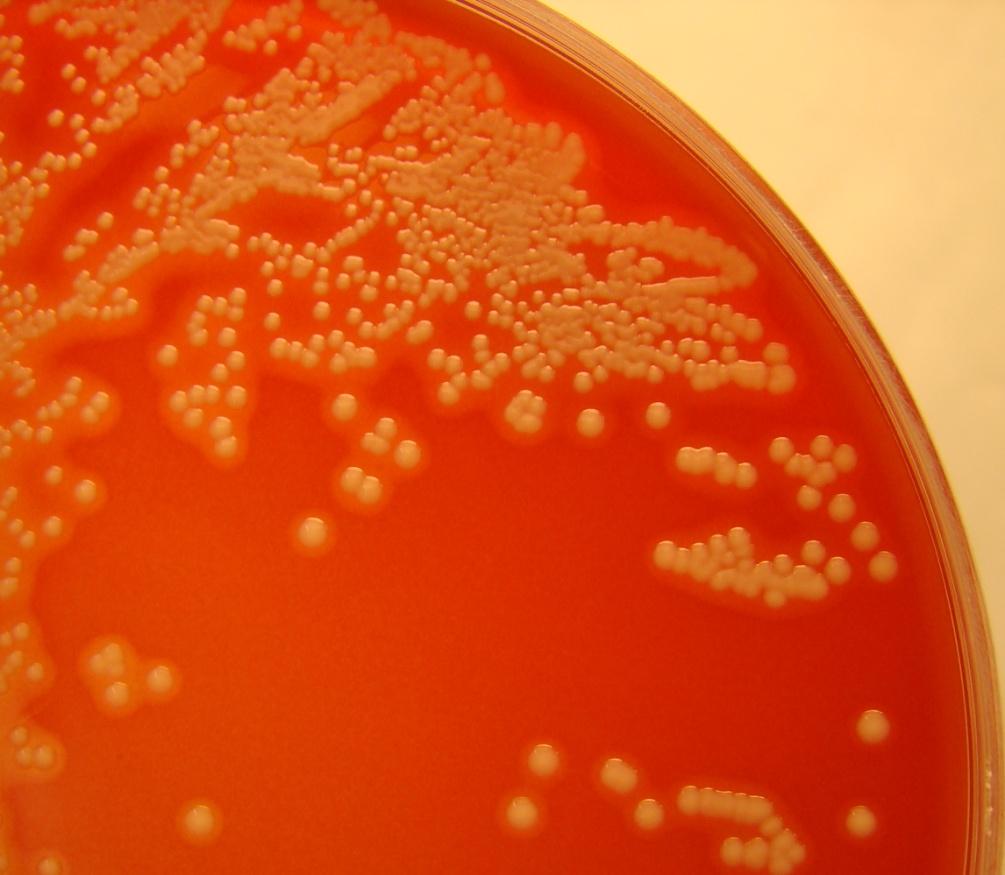 Näyte 1/2011. Staphylococcus aureus S.