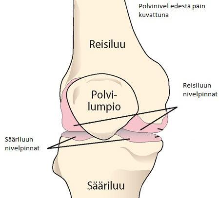 Polvinivelen rakenne ja toiminta Polvinivel (kuva 1) sijaitsee reisiluun ja sääriluun välillä. Kyseessä on sarananivel, joka mahdollistaa polven ojennuksen ja koukistuksen.