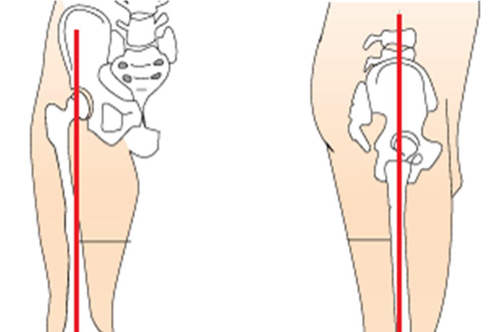 Polvinivel on osa alaraajan kineettistä ketjua (kuva 2), johon kuuluvat myös keskivartalo, lonkka sekä nilkkanivel. Kyseisessä ketjussa kehon lihakset ja nivelet toimivat yhdessä.