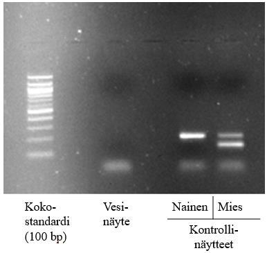 21 johtuen PCR-tuotteet erottuvat AGE-ajossa kahtena eri fragmenttina, kuten kuvassa 1. Jos näyte on naisesta, saadaan vain X-kromosomin fragmenttia.