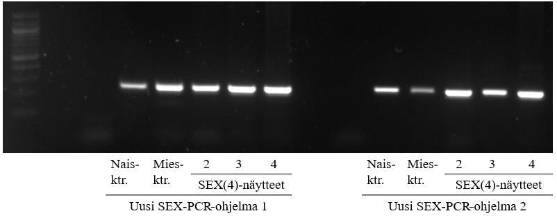 39 Kahdeksas testi käsitti etanolisaostuksella manuaalisesti eristetyt SEX(3)-näytteet, Ficoll-prosessin lopputuotteen soluista manuaalisesti eristetyt SEX(4)-näytteet sekä verestä manuaalisesti