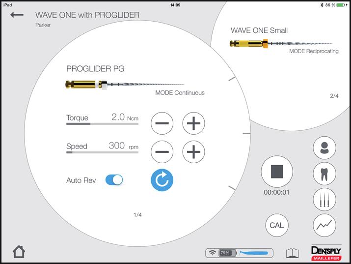 Vaihekohtaiset ohjeet 6.7.5.3 Hoidon aloittaminen ja tallentaminen Start Treatment -kohdan painikkeet ja toiminnot ovat käytettävissä myös Start and Record Treatment -kohdassa.