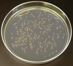 Yhdistelmä-DNA:n monistaminen bakteereissa Escherichia coli -bakteerin pesäkkeitä agaroosimaljalla Yhdistelmä-DNA (tyypillisesti plasmidi- DNA:na) siirretään bakteeriin transformaatioreaktiolla