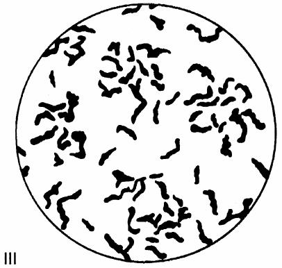 16 Kuva 5. Tylppägrafiittivaluraudan grafiitin muoto 100x suurennoksella. (SFS-EN ISO 945-1:en 2008, s.