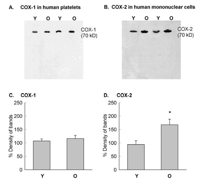 Infek+o lisää val+mon prostanoidiriippuvuu<a COX- 2:n ilmentyminen lisääntyy iäkkäillä Increased prostanoid dependency of arterial relaxa+on in Chlamydia