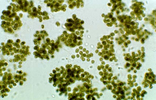 Yleisimpiä massaesiintymiä muodostavat suvut, Microcystis, Anabaena ja Planktothrix (Kuva 1), voivat tuottaa maksa-, solu- ja hermotoksiineja.