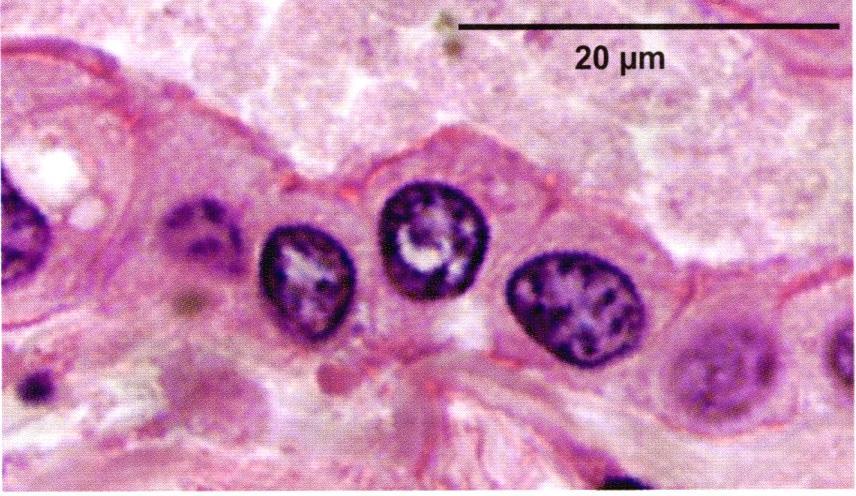 Nucleolus
