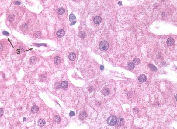 Valomikroskooppinen histologinen kudostutkimus on edelleen tärkein patologian alan diagnostinen menetelmä