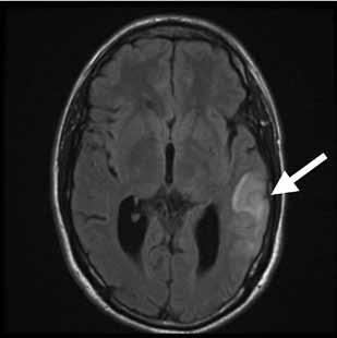 TAPAUSSELOSTUS A B C KUVA 1.