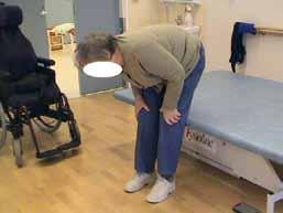 TAPAUSSELOSTUS Selän koukistuminen on sittemmin edennyt niin nopeasti, ettei potilas enää pysty kävelemään vaan joutuu käyttämään pyörätuolia.
