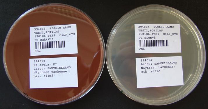 Kiinnitä maljojen pohjiin näytetarrat (4) ja toimita maljat heti sen jälkeen mikrobiologian laboratorioon