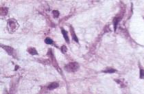 tunnistaa veren solut valomikroskoopilla niiden rakenteen ja värjäytyvyyden perusteella Ennakkotehtävät sidekudoksen tarkasteluun: Ennen mikroskopiatyötä käy läpi tässä