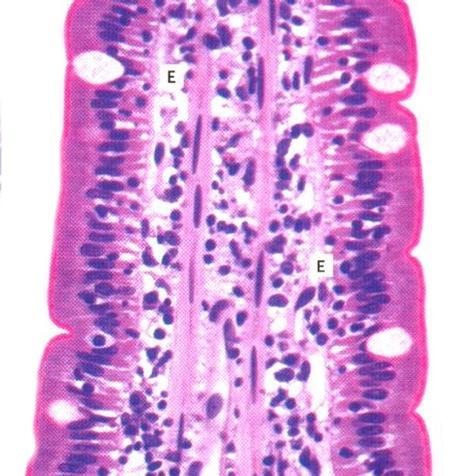 Submukosa on tiivistä sidekudosta huomaa, että tumia on vain siellä täällä. Pääosa kudoksesta koostuu soluväliaineen kollageenista. Valmiste #10. Verkkomainen sidekudos. Imusolmuketta.
