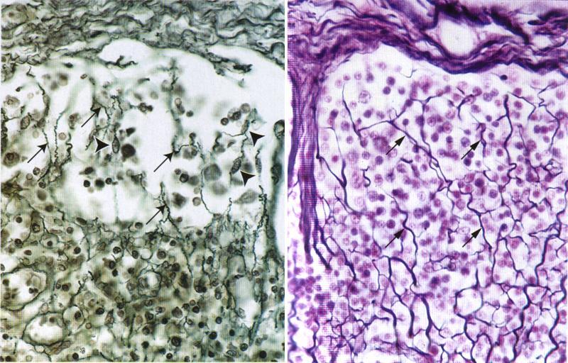 plasmasoluja Lieberkühnin krypta Jeffrey B Kerr: Atlas of Functional Histology, Mosby Lieberkühnin krypta Suolen villusten sisällä on myös löyhää sidekudosta - joukossa mm.