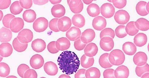 Agranulosyytti: - Sytoplasmassa ei ole näkyvissä merkittäviä jyväsiä. - Tuma on selvästi yksiosainen (vanhalta nimeltään mononukleaarinen valkosolu) 2. Mikä kolmesta granulosyytistä? a.