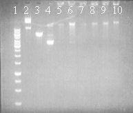 44 9 ja 10 ovat käsittelemättömät DpnI-digestoidut näytteet eli RCA:n konkatameerista valmistettuja. Kuva 11: DpnI-digestio plasmidille pix/pak100r-loxp1r. Näyte 1 on DNA kokostandardi.