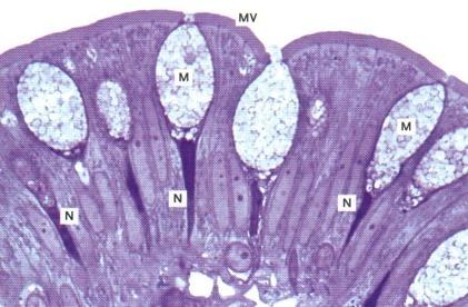 yhteydessä (neurobiologia-jakso) Epiteeli erottaa, estää ja torjuu - erittää, aistii ja uusiutuu. Epiteelikudokset kuuluvat side-, lihas- ja hermokudoksen ohella peruskudoksiin.