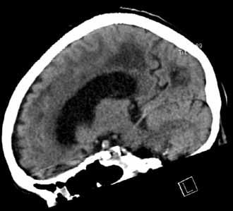 Menetelmän soveltaminen yksilötasolla kliinisessä diagnostiikassa on toivon mukaan mahdollista lähitulevaisuudessa.