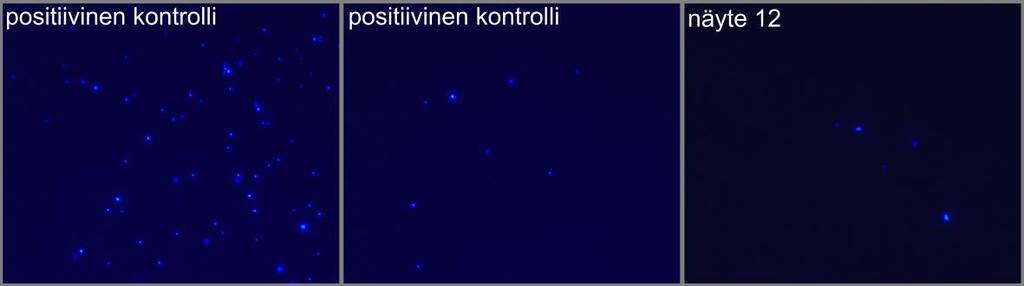 35 6.3 Luminesenssimenetelmä MycoAlert -kitillä yksi näyte jäi epäselväksi, oliko se negatiivinen vai positiivinen. Kaikki muut näytteet osoittautuivat negatiivisiksi.