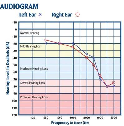 85dB AUDIOGRAMMISTA SELVIÄÄ