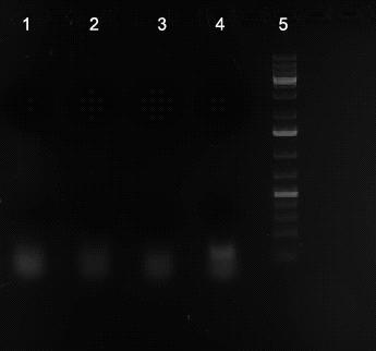 24 Kuva 2. Potilasnäytteestä monistettu HPEV3-viruksen VP1-PCR-tuote (700 bp). Rivit 1-4. HPEV3, 5. 1kb-DNAkokostandardi.