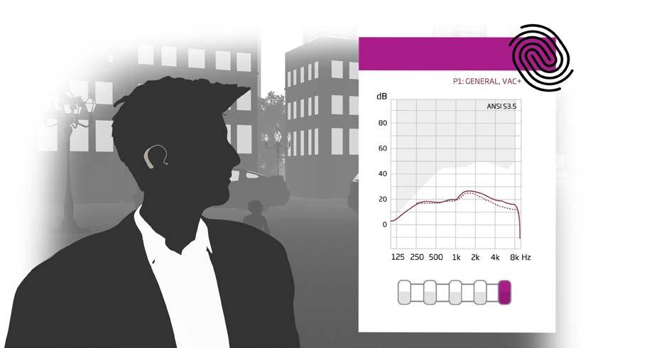 Parempaa äänenlaatua dynaamiselle kuuloalueelle Clear Dynamics laajentaa dynaamista ottotasoaluetta käsitellen jopa 113 db SPL:n äänisignaaleja.