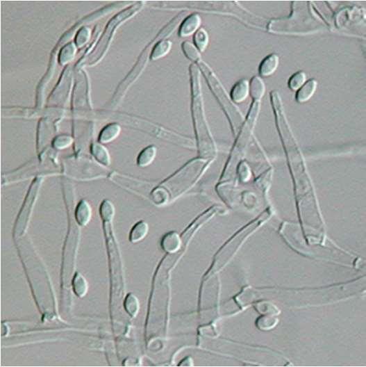 23 Mikroskopian avulla tunnistaminen tapahtuu tunnistamalla homeiden kuromakannattimien rakenteita, kuromaitiöiden ominaisuuksia, sekä suvuttomien kuromaitiöiden syntytapaa. (6, s. 312.