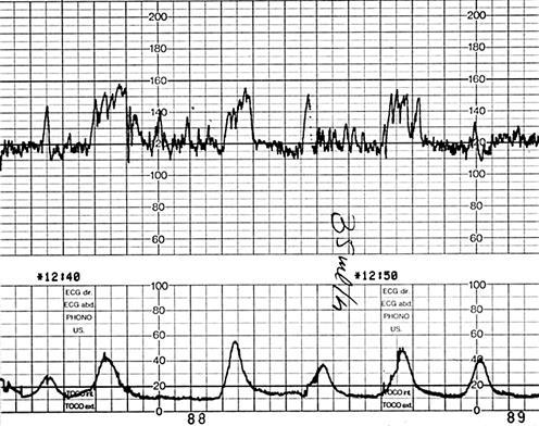 11 magnesium ja rauhoittavat lääkkeet (Keski-Nisula 2000, 473).