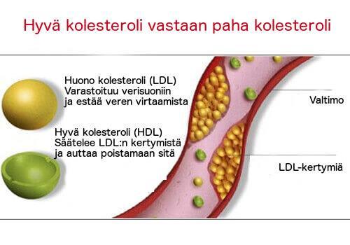 Hyvä vastaan