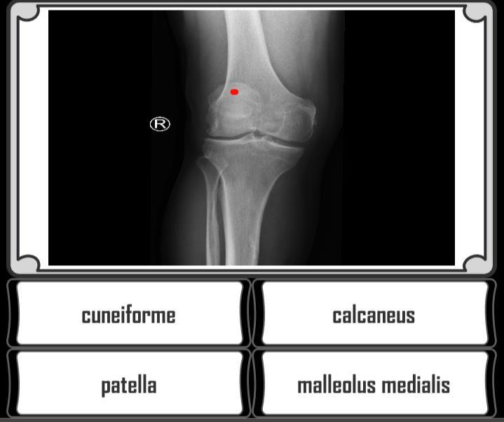 22 Kuvio 5. Ruudunkaappaus anatomia-pelistä; vaikeustaso helppo 8.3 Videoiden toteuttaminen Kay M.