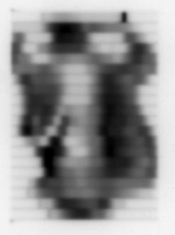 Kuva 3. Röntgenfilmi, joka on valotettu lineaarikiihdyttimestä tulevalla säteilyllä ja liikuttelemalla sädehoidon aikana moniliuskarajaimen liuskoja vaihtelevalla nopeudella.