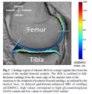 Increase in femoral neck strength No adverse effects in knee